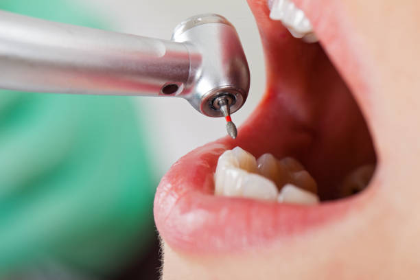 Emergency Cosmetic Dentistry